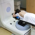 放射線治療を受ける女性